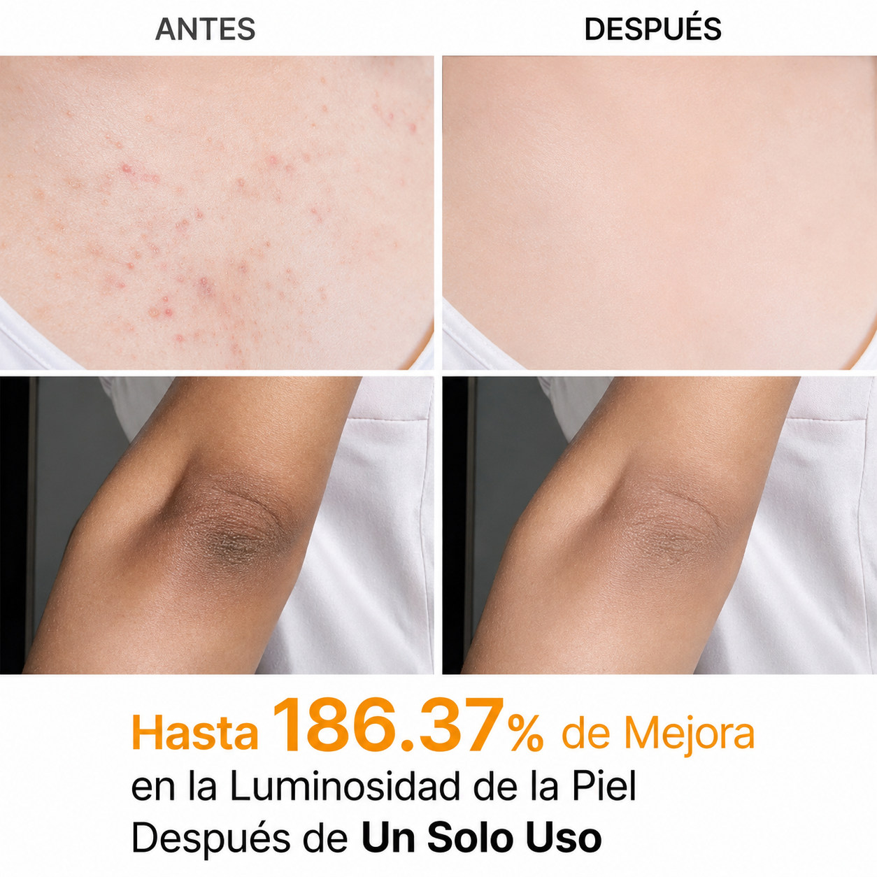 Dr. Melaxin – Spray Exfoliante con Ácido Kójico y Cúrcuma Peel Shot | 200 ml