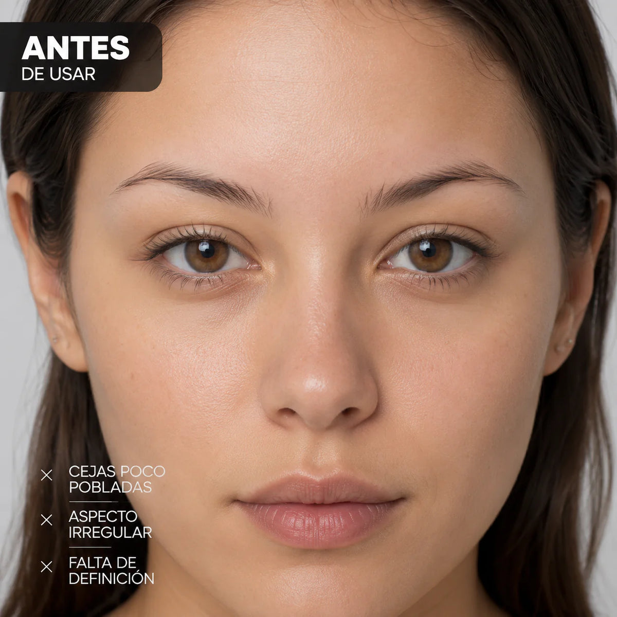ANTES